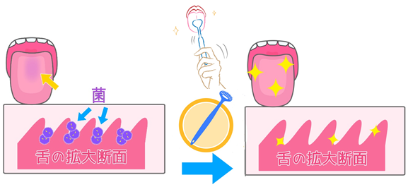 舌の拡大断面