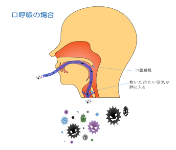 口呼吸