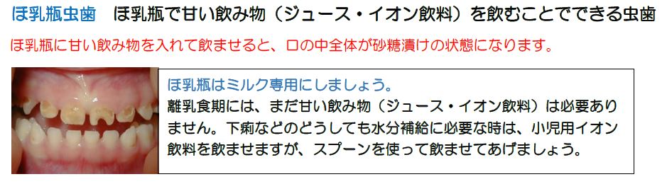 ほ乳う蝕